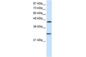 WB Suggested Anti-HES6 Antibody Titration:  1.