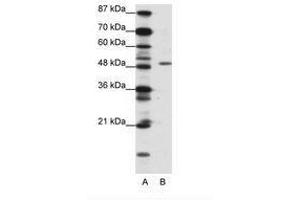 Image no. 1 for anti-Zinc finger protein ubi-d4 (DPF2) (N-Term) antibody (ABIN202412) (DPF2 Antikörper  (N-Term))