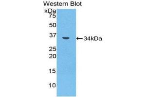 Western Blotting (WB) image for anti-Matrix Metallopeptidase 7 (Matrilysin, Uterine) (MMP7) (AA 1-264) antibody (ABIN1859856) (MMP7 Antikörper  (AA 1-264))