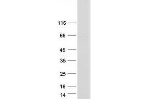 Validation with Western Blot (POC5 Protein (Transcript Variant 2) (Myc-DYKDDDDK Tag))