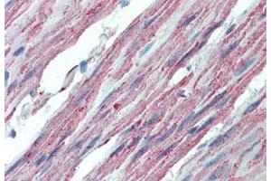 Immunohistochemistry (Formalin/PFA-fixed paraffin-embedded sections) of human colon tissue with ITGA3 polyclonal antibody .