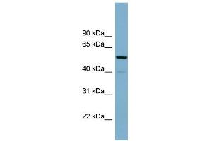 WB Suggested Anti-CDK5RAP1 Antibody Titration: 0. (CDK5RAP1 Antikörper  (N-Term))