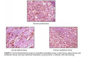 Image no. 1 for anti-Dynamin 1 (DNM1) antibody (ABIN232098) (Dynamin 1 Antikörper)
