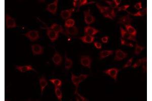 ABIN6275199 staining NIH-3T3 by IF/ICC. (ICAM2 Antikörper  (Internal Region))