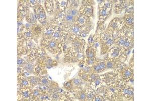 Immunohistochemistry of paraffin-embedded Mouse liver using CYP2C18 Polyclonal Antibody at dilution of 1:100 (40x lens). (CYP2C18 Antikörper)