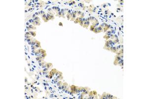 Immunohistochemistry of paraffin-embedded mouse lung using BMP5 antibody (ABIN5974675) at dilution of 1/100 (40x lens). (BMP5 Antikörper)