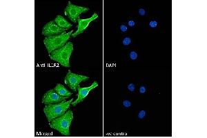 (ABIN570867) Immunofluorescence analysis of paraformaldehyde fixed A549 cells, permeabilized with 0. (IL1R2 Antikörper  (Internal Region))