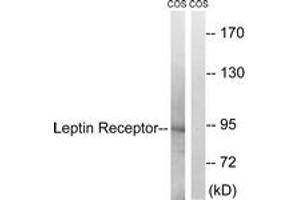 Western blot analysis of extracts from COS7 cells, treated with calyculinA 50ng/ml 30', using Leptin Receptor (Ab-1141) Antibody. (Leptin Receptor Antikörper  (AA 1107-1156))