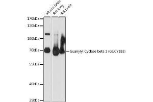 Western blot analysis of extracts of various cell lines, using Guanylyl Cyclase beta 1 (Guanylyl Cyclase beta 1 (GUCY1B3)) antibody (ABIN7267552) at 1:1000 dilution. (GUCY1B3 Antikörper  (AA 1-250))