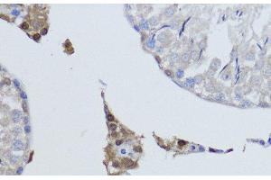 Immunohistochemistry of paraffin-embedded Rat testis using ESRRA Polyclonal Antibody at dilution of 1:200 (40x lens). (ESRRA Antikörper)
