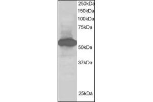 Antibody staining (1 µg/ml) of Human Kidney lysate (RIPA buffer, 30 µg total protein per lane). (SIL1 Antikörper  (C-Term))