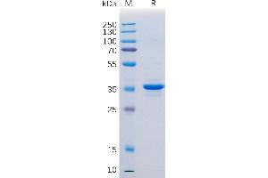 SDS-PAGE (SDS) image for Membrane-Spanning 4-Domains, Subfamily A, Member 1 (MS4A1) protein (Fc Tag) (ABIN7092665)
