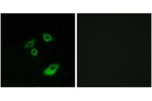 Immunofluorescence analysis of A549 cells, using BCL-2 (Phospho-Thr56) Antibody. (Bcl-2 Antikörper  (pThr56))