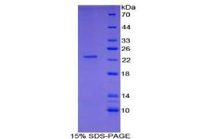 SDS-PAGE analysis of Human Shisa Homolog 4 Protein. (SHISA4 Protein)