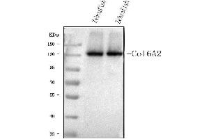 Western blot analysis of Col6a2 using anti-Col6a2 antibody (ABIN7602398).