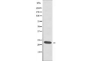 Western blot analysis of extracts from COLO cells using RPL18 antibody. (RPL18 Antikörper)