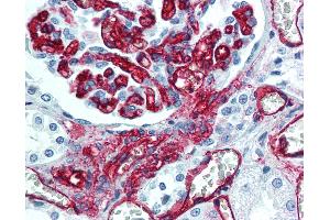 Anti-CD34 antibody IHC of human kidney, endothelium.