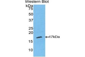 Western blot analysis of the recombinant protein. (TNFRSF19 Antikörper  (AA 222-363))