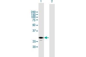 Western Blot analysis of ECHS1 expression in transfected 293T cell line by ECHS1 MaxPab polyclonal antibody. (ECHS1 Antikörper  (AA 1-290))