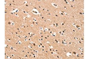 The image on the left is immunohistochemistry of paraffin-embedded Human brain tissue using ABIN7190422(CYP46A1 Antibody) at dilution 1/15, on the right is treated with synthetic peptide. (CYP46A1 Antikörper)