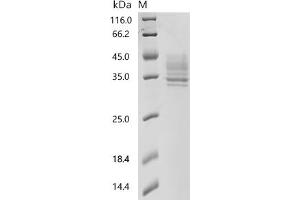 (Tris-Glycine gel) Discontinuous SDS-PAGE (reduced) with 5 % enrichment gel and 15 % separation gel.