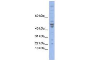 Image no. 1 for anti-Polymerase (DNA-Directed), epsilon 4 (p12 Subunit) (POLE4) (N-Term) antibody (ABIN6742852) (POLE4 Antikörper  (N-Term))