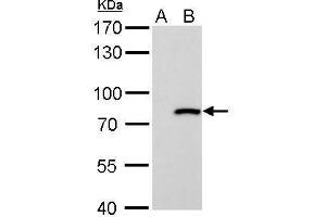 Western Blotting (WB) image for anti-Myxovirus Resistance Protein 1 (MX1) (Internal Region) antibody (ABIN2856746)