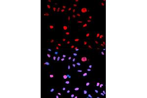 Immunofluorescence (IF) image for anti-Mdm2, p53 E3 Ubiquitin Protein Ligase Homolog (Mouse) (MDM2) (pSer166) antibody (ABIN1870422) (MDM2 Antikörper  (pSer166))