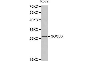 Western blot analysis of extracts of K562 cells tissue, using SOCS3 antibody. (SOCS3 Antikörper  (C-Term))