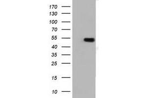 Western Blotting (WB) image for anti-Tubulin, alpha 3e (TUBA3E) antibody (ABIN1501557) (TUBA3E Antikörper)