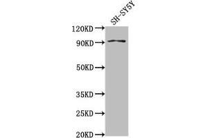 Western Blot Positive WB detected in: SH-SY5Y whole cell lysate All lanes: GPLD1 antibody at 1:2000 Secondary Goat polyclonal to rabbit IgG at 1/50000 dilution Predicted band size: 93, 20 kDa Observed band size: 93 kDa (GPLD1 Antikörper  (AA 310-565))