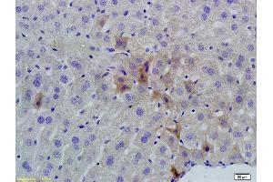 Formalin-fixed and paraffin embedded mouse liver labeled with Rabbit Anti phospho-GCN2 (Thr667) Polyclonal Antibody, Unconjugated (ABIN684958) at 1:200 followed by conjugation to the secondary antibody and DAB staining (GCN2 Antikörper  (pThr667))