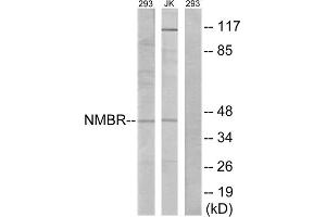 Western blot analysis of extracts from 293 cells and Jurkat cells, using NMBR antibody. (NMBR Antikörper  (Internal Region))