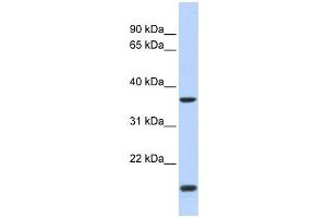Western Blotting (WB) image for anti-Zic Family Member 4 (ZIC4) antibody (ABIN2458430) (ZIC4 Antikörper)