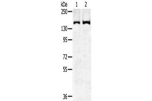 Gel: 6 % SDS-PAGE,Lysate: 40 μg,Lane 1-2: Hela cells, K562 cells,Primary antibody: ABIN7192310(SENP6 Antibody) at dilution 1/450 dilution,Secondary antibody: Goat anti rabbit IgG at 1/8000 dilution,Exposure time: 5 minutes (SENP6 Antikörper)