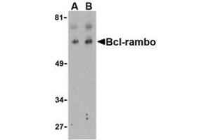 Western blot analysis of Bcl-rambo in K562 cell lysate with AP30131PU-N Bcl-rambo antibody at (A) 2 and (B) 4 μg/ml.