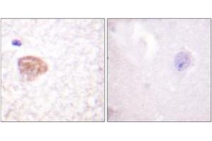 Immunohistochemistry (IHC) image for anti-DEAD (Asp-Glu-Ala-Asp) Box Polypeptide 3, X-Linked (DDX3X) (AA 466-515) antibody (ABIN2888820) (DDX3X Antikörper  (AA 466-515))