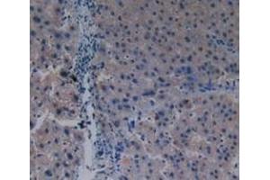 Detection of PAK1 in Human Liver Tissue using Polyclonal Antibody to p21 Protein Activated Kinase 1 (PAK1) (PAK1 Antikörper  (AA 252-501))