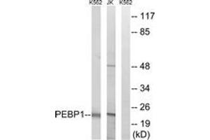 Western Blotting (WB) image for anti-Phosphatidylethanolamine Binding Protein 1 (PEBP1) (AA 105-154) antibody (ABIN2890498) (PEBP1 Antikörper  (AA 105-154))
