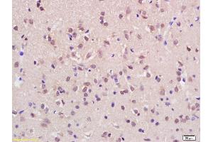 Formalin-fixed and paraffin embedded rat brain labeled with Rabbit Anti KMT2H/ASH1L Polyclonal Antibody, Unconjugated (ABIN1387873) at 1:200 followed by conjugation to the secondary antibody and DAB staining (ASH1L Antikörper  (AA 1985-2060))