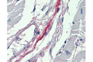 DDAH2 antibody was used for immunohistochemistry at a concentration of 4-8 ug/ml. (DDAH2 Antikörper  (N-Term))