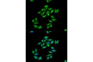 Immunofluorescence analysis of A-549 cells using CPT1A antibody. (CPT1A Antikörper  (AA 497-756))