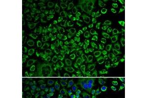Immunofluorescence analysis of A549 cells using F10 Polyclonal Antibody (Coagulation Factor X Antikörper)