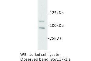 Image no. 1 for anti-Mast/stem Cell Growth Factor Receptor (KIT) antibody (ABIN1112872) (KIT Antikörper)