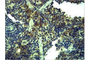 Immunohistochemistry (IHC) image for anti-Toll-Like Receptor 1 (TLR1) antibody (ABIN3181539)