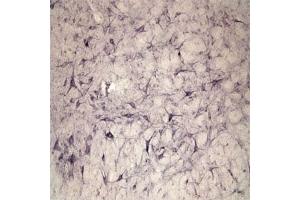 IHC on rat spinal cord using Rabbit antibody to extracellular, N-terminal part of Sortilin (Neurotensin receptor 3, NTR3, Sort1): IgG  at a concentration of 10 µg/ml. (Sortilin 1 Antikörper)