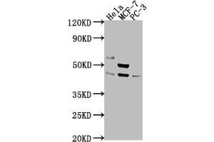 Western Blot Positive WB detected in: Hela whole cell lysate, MCF-7 whole cell lysate, PC-3 whole cell lysate All lanes: POU4F1 antibody at 1:2000 Secondary Goat polyclonal to rabbit IgG at 1/50000 dilution Predicted band size: 43, 34 kDa Observed band size: 43 kDa (POU4F1 Antikörper  (AA 258-419))