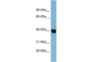 WB Suggested Anti-C14orf148 Antibody Titration: 0. (NOXRED1 Antikörper  (Middle Region))