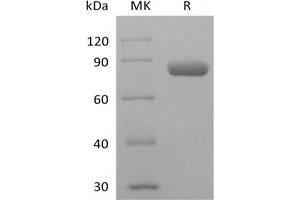 Western Blotting (WB) image for Nectin-2 (NECTIN2) protein (Fc Tag) (ABIN7319926)