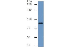 Rabbit Capture antibody from the kit in WB with Positive Control: Sample Human Serum. (PLG ELISA Kit)